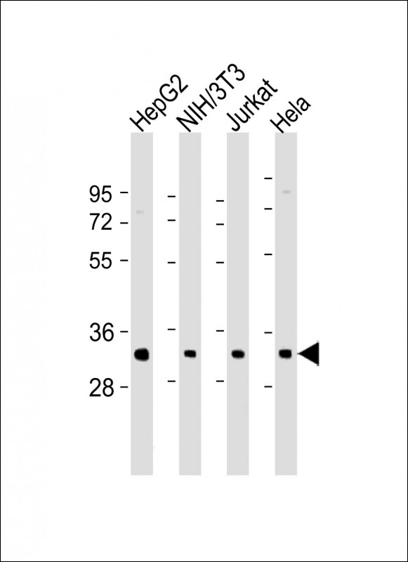 Rabbit Polyclonal Antibody to RPS2 (N-Term)