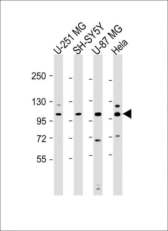 Rabbit Polyclonal Antibody to SH3PXD2B