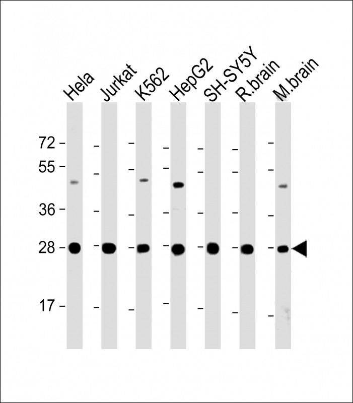 Rabbit Polyclonal Antibody to HSD17B10