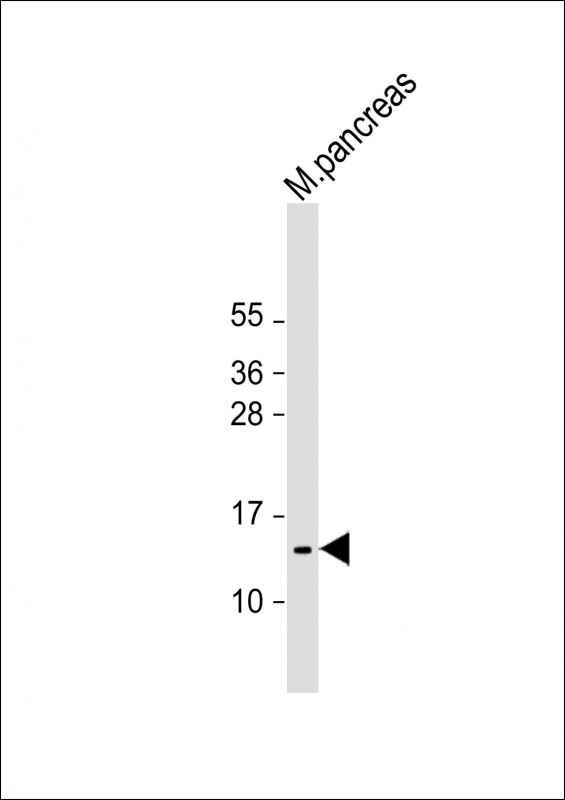 Rabbit Polyclonal Antibody to POLR2F (N-Term)
