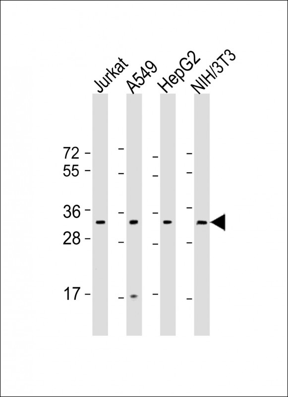 Rabbit Polyclonal Antibody to RPS2