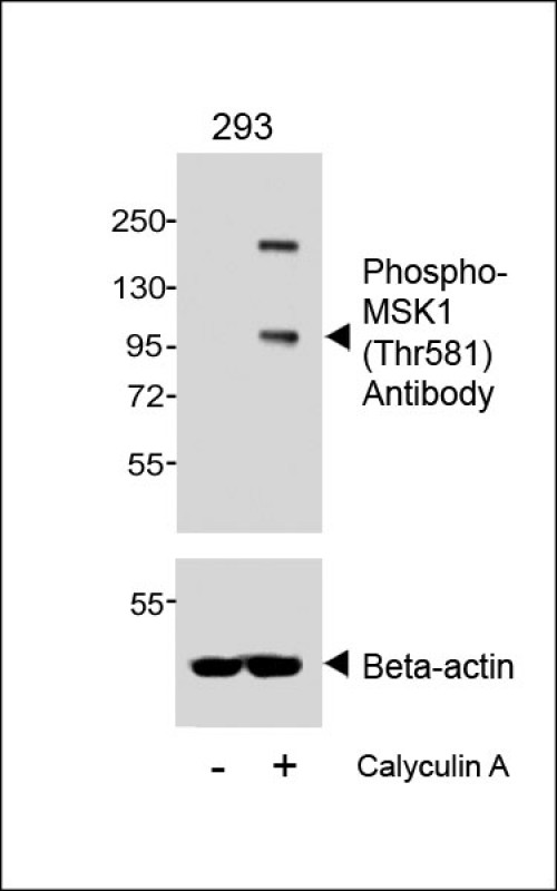 Rabbit Polyclonal Antibody to Phospho-MSK1 (Thr581)
