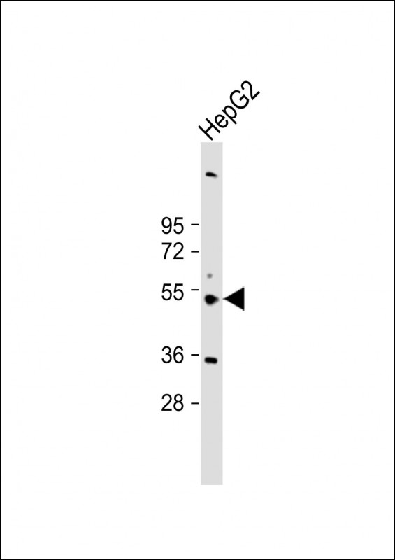 Rabbit Polyclonal Antibody to CYP3A43
