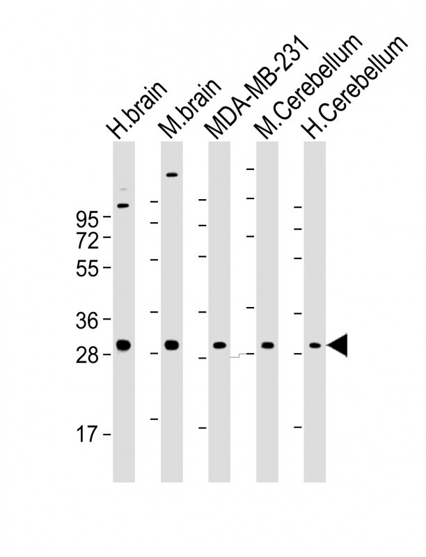 Mouse Monoclonal Antibody to RAB23