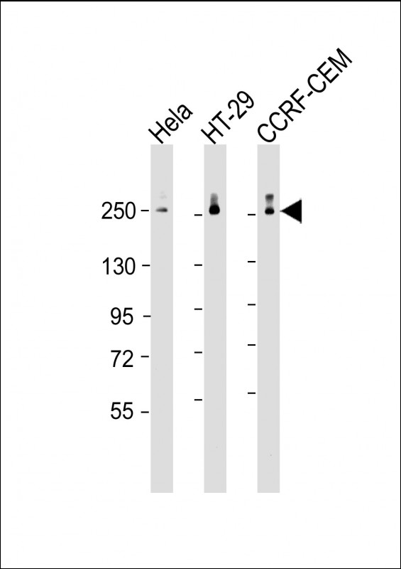 Mouse Monoclonal Antibody to POLR2A (monoclonal) (M01AA)