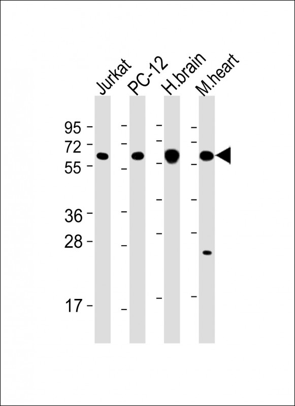 Mouse Monoclonal Antibody to CAMK2 beta