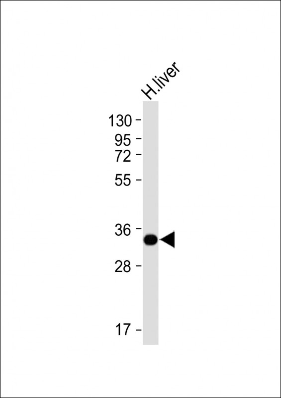Mouse Monoclonal Antibody to GNMT