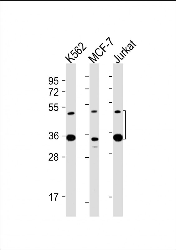 Mouse Monoclonal Antibody to MBD2