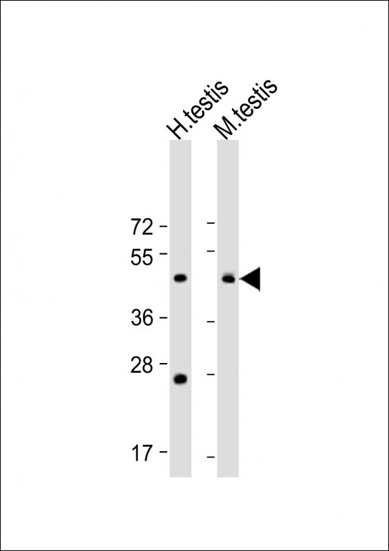 Rabbit Polyclonal Antibody to BSCL2 (N-term)