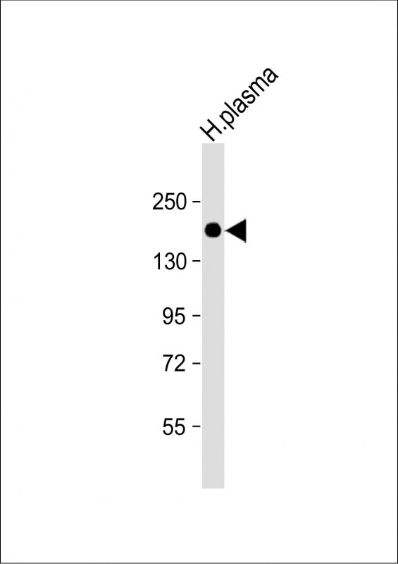 Rabbit Polyclonal Antibody to CFH