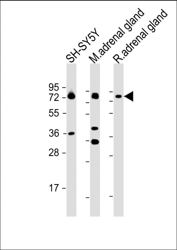 Rabbit Polyclonal Antibody to DBH (N-term P42)