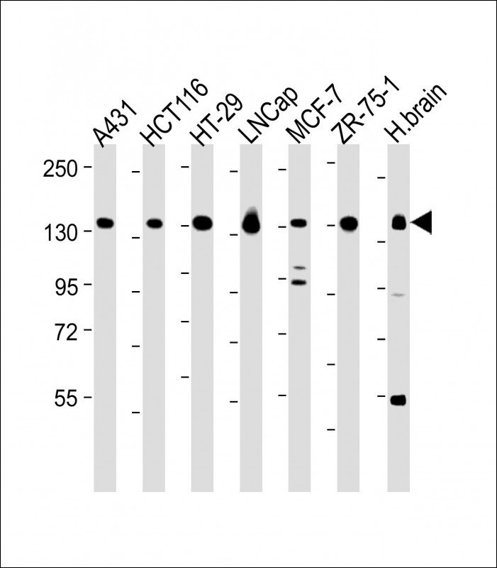 Rabbit Polyclonal Antibody to MYO6 (C-term R1181)