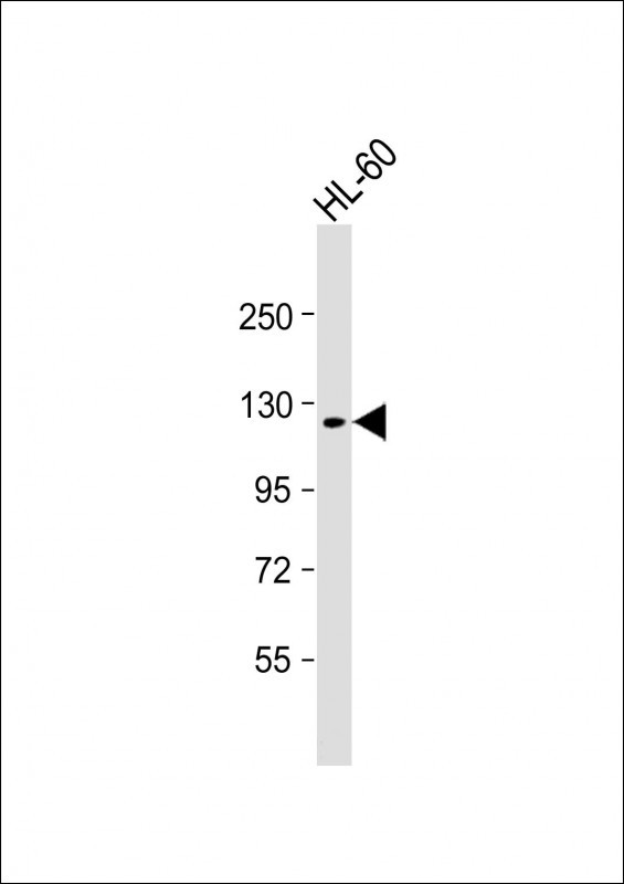 Rabbit Polyclonal Antibody to TERT (S1125)