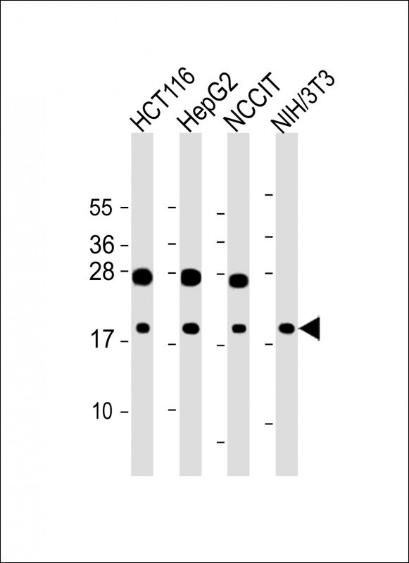 Rabbit Polyclonal Antibody to HMGA2 (N-term)
