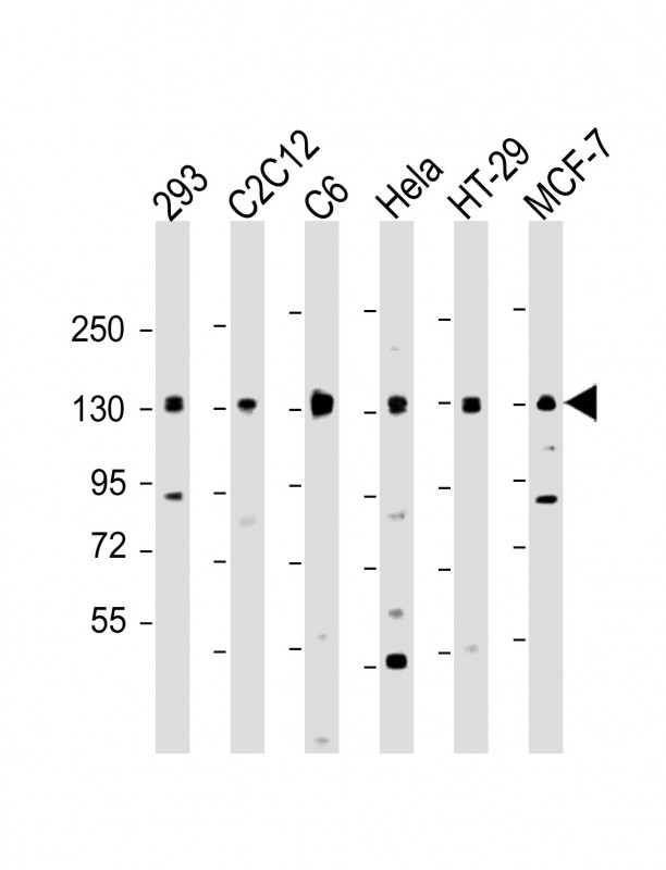 Rabbit Polyclonal Antibody to MYPT1 (Thr852)