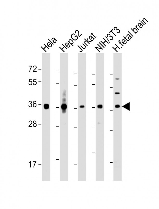 Rabbit Polyclonal Antibody to MATH1/HATH1/ATOH1 (N-term)