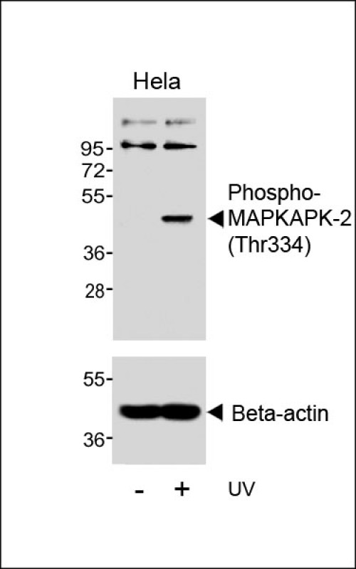 Rabbit Polyclonal Antibody to Phospho-MAPKAPK-2 (Thr334)