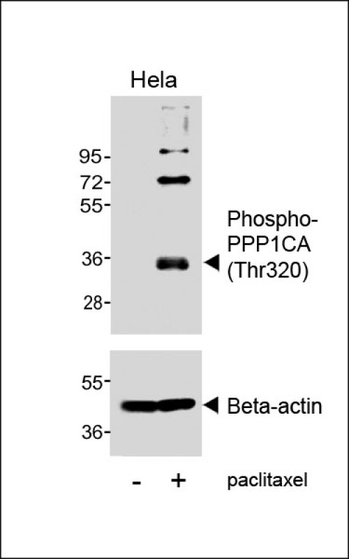 Rabbit Polyclonal Antibody to Phospho-PPP1CA (Thr320)