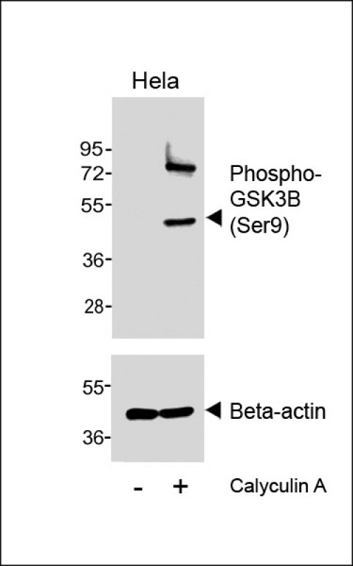 Rabbit Polyclonal Antibody to Phospho-GSK3B (Ser9)
