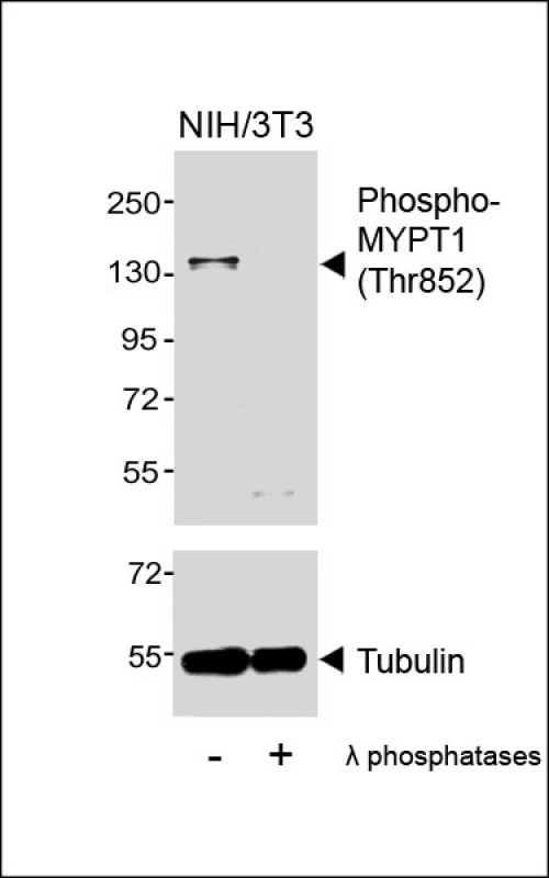 Rabbit Polyclonal Antibody to Phospho-MYPT1 (Thr852)