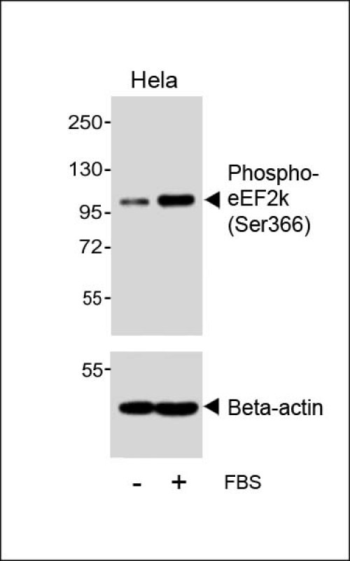 Rabbit Polyclonal Antibody to Phospho-eEF2k (Ser366)