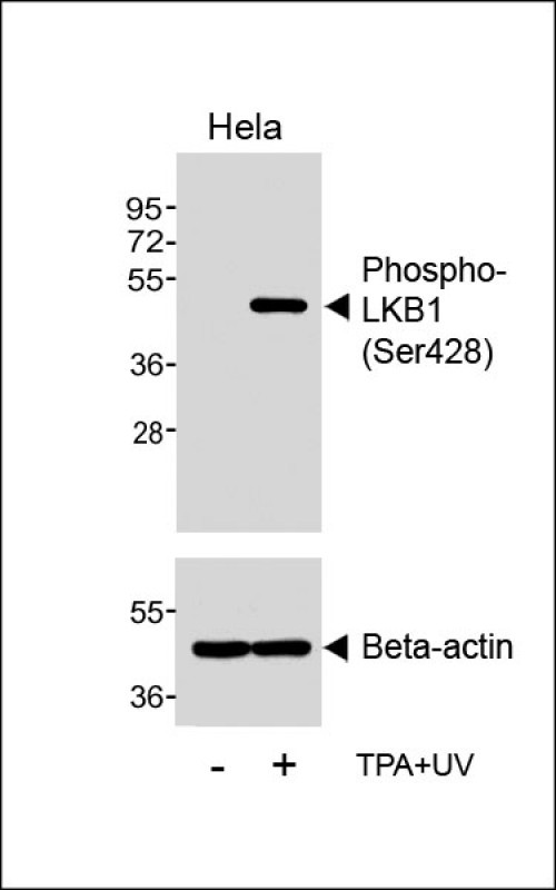 Rabbit Polyclonal Antibody to Phospho-LKB1 (Ser428)