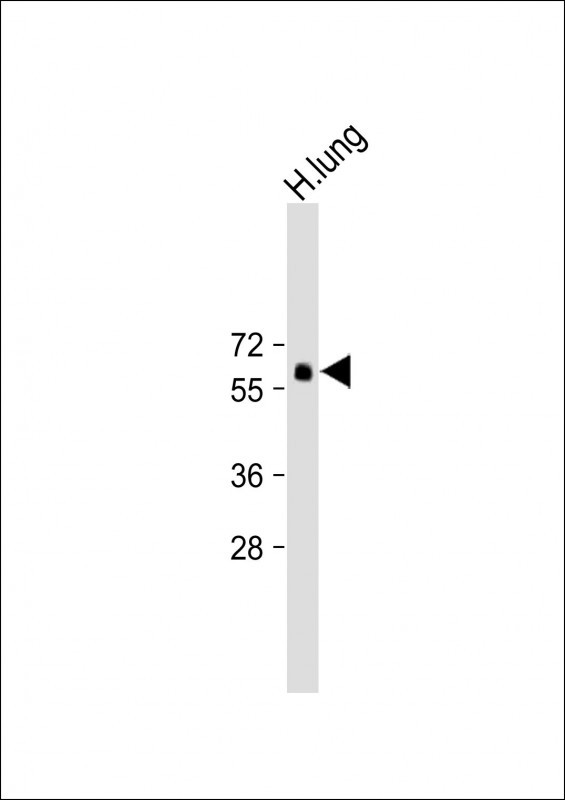 Rabbit Polyclonal Antibody to SMAD6