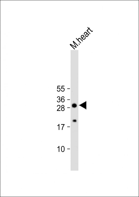 Rabbit Polyclonal Antibody to AQP11