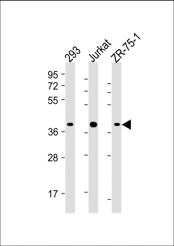 Mouse Monoclonal Antibody to HIF1AN