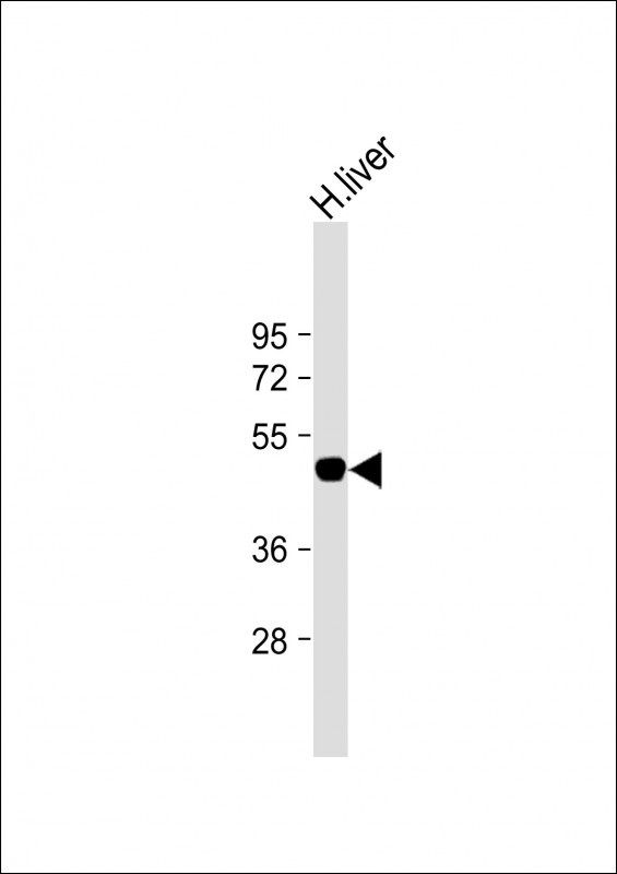 Rabbit Polyclonal Antibody to SLC39A14 (N-term)