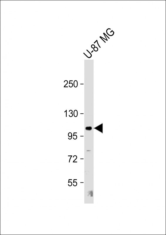 Rabbit Polyclonal Antibody to THBS4(C-term)
