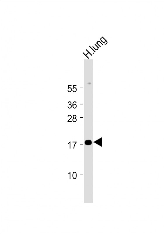 Rabbit Polyclonal Antibody to RARRES2 (N-Term)