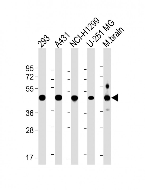 Rabbit Polyclonal Antibody to NSFL1C