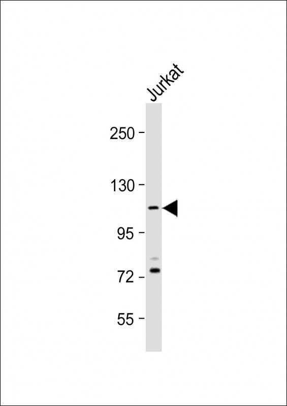 Rabbit Polyclonal Antibody to PKN1