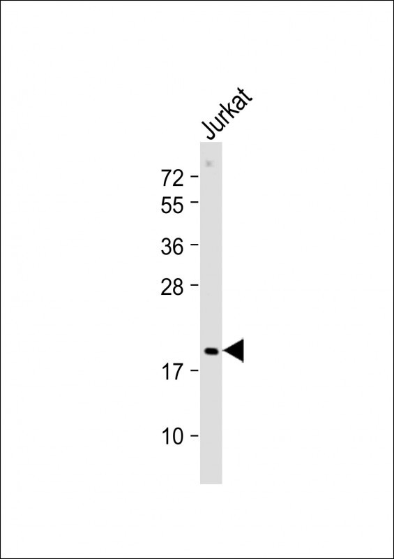Rabbit Polyclonal Antibody to p19 (N-term)