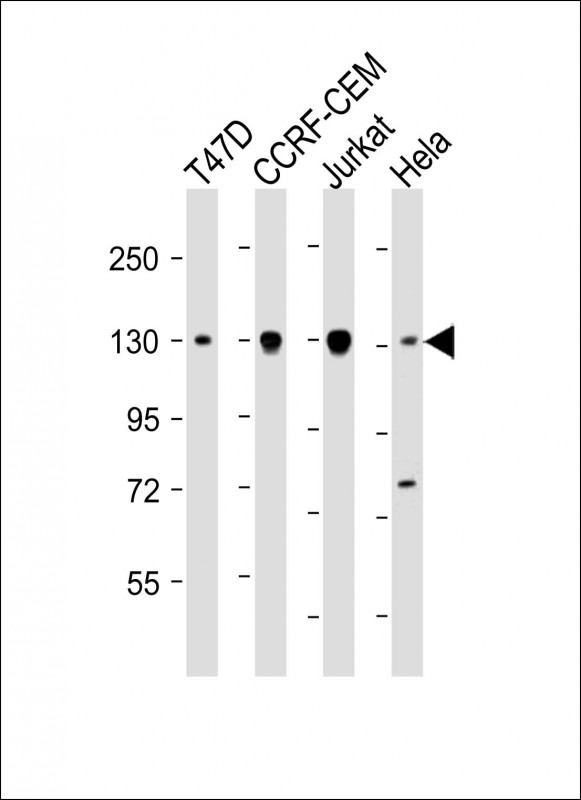 Mouse Monoclonal Antibody to Dnmt3a