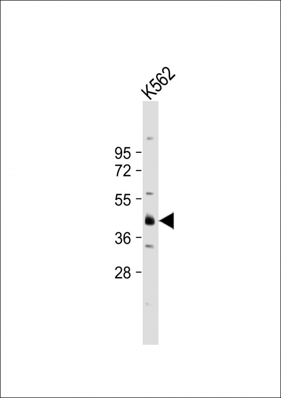Rabbit Polyclonal Antibody to YOD1