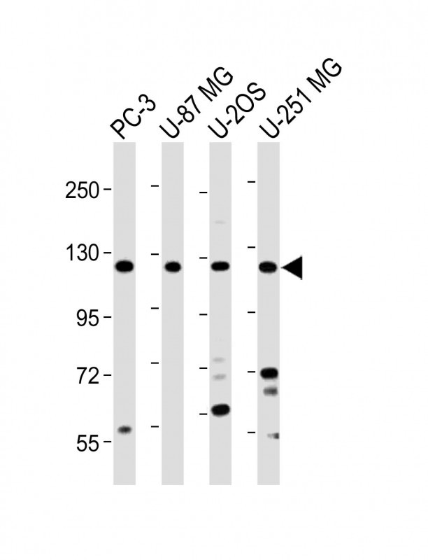 Rabbit Polyclonal Antibody to K0746 (N-term)