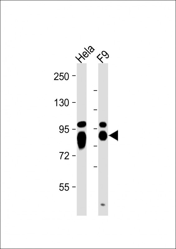 Rabbit Polyclonal Antibody to ALPL