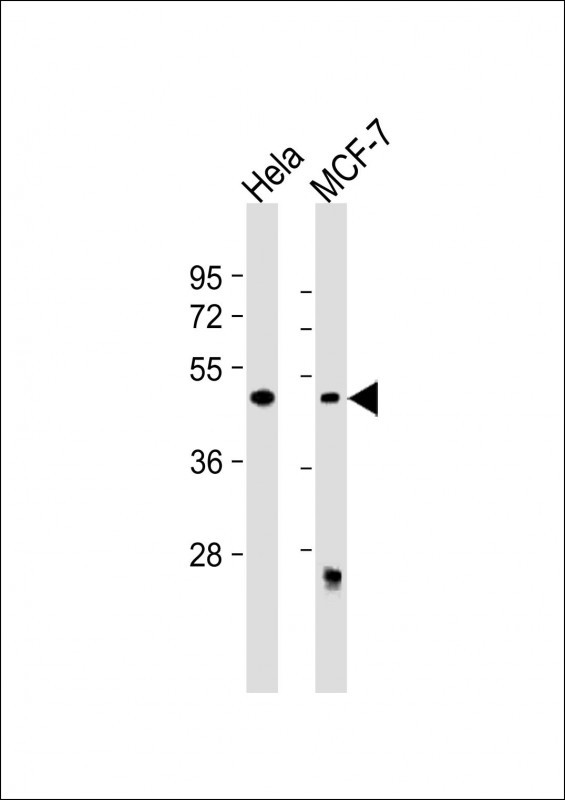 Rabbit Polyclonal Antibody to ALKBH5
