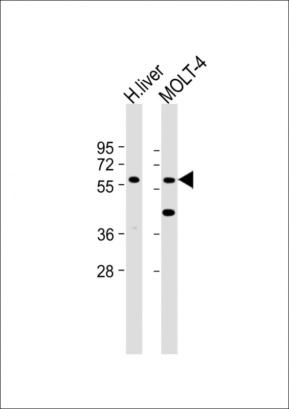 Rabbit Polyclonal Antibody to GLT8D4(C-term)