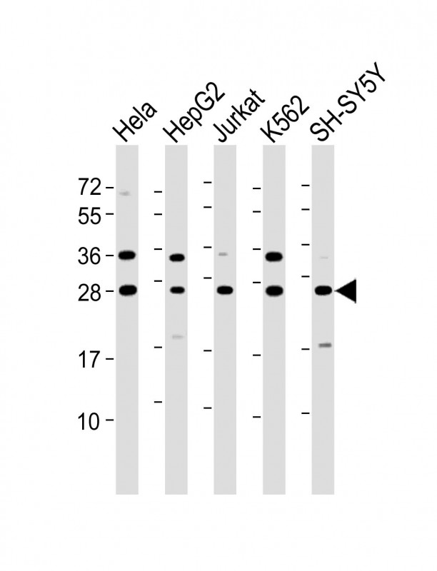 Rabbit Polyclonal Antibody to HSD17B10 (N-Term)