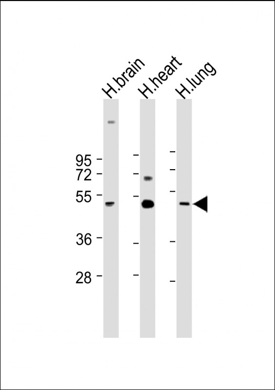 Rabbit Polyclonal Antibody to CX3CL1