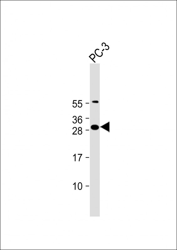 Rabbit Polyclonal Antibody to FAM125A (N-Term)