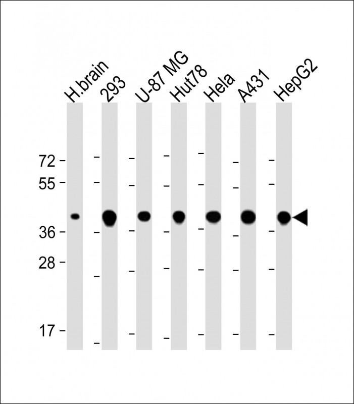 Rabbit Polyclonal Antibody to TOMM40 (N-Term)