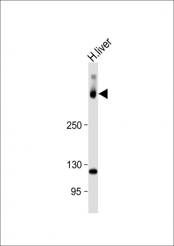 Rabbit Polyclonal Antibody to SYNE2 (N-Term)