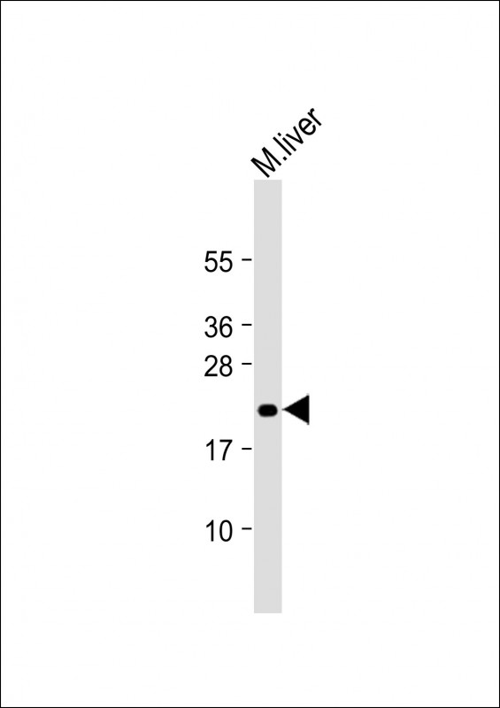 Rabbit Polyclonal Antibody to MIF4GD