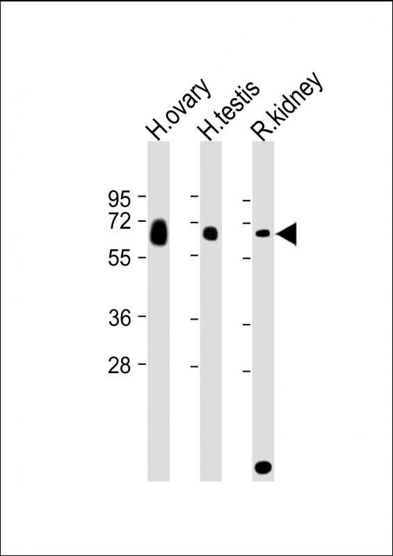Rabbit Polyclonal Antibody to GGT3P
