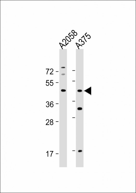 Rabbit Polyclonal Antibody to ST8SIA1 (N-Term)