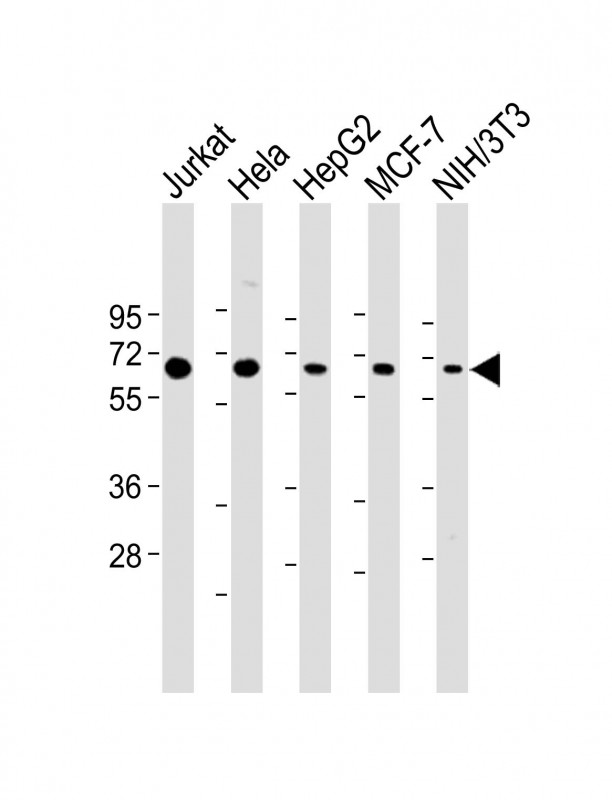 Rabbit Polyclonal Antibody to PSMD3